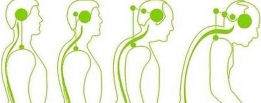 Cervical spine loses mobility
